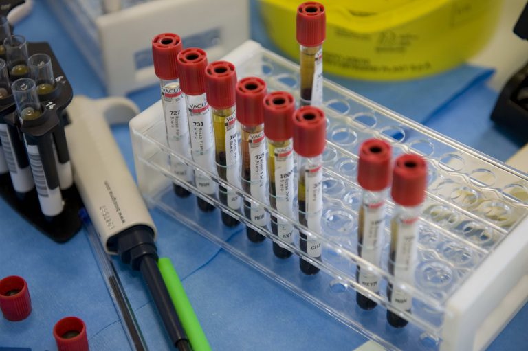 Il lungo cammino contro il cancro del team della Cusano